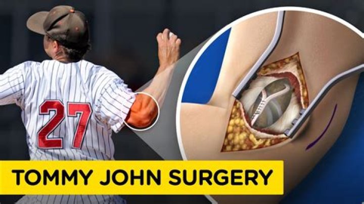 
How Old Is Tommy John Son? Tommy John III Career Details Explored 